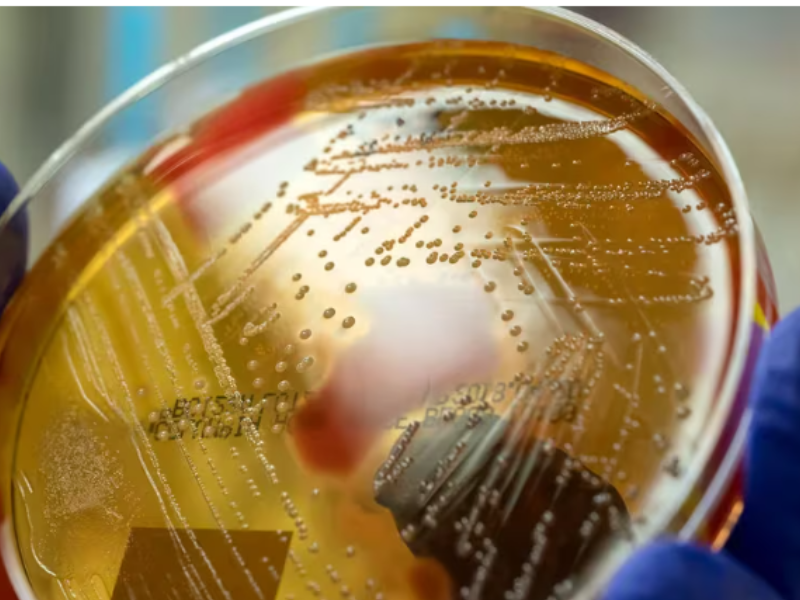 Los detalles de la enfermedad bacteriana que se extiende en Japón y pone en alerta a los expertos