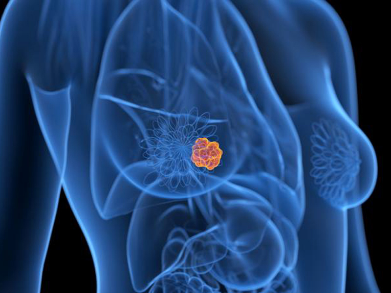 Cómo funcionan las vacunas contra el cáncer que son parte de un ensayo en varios países de Europa