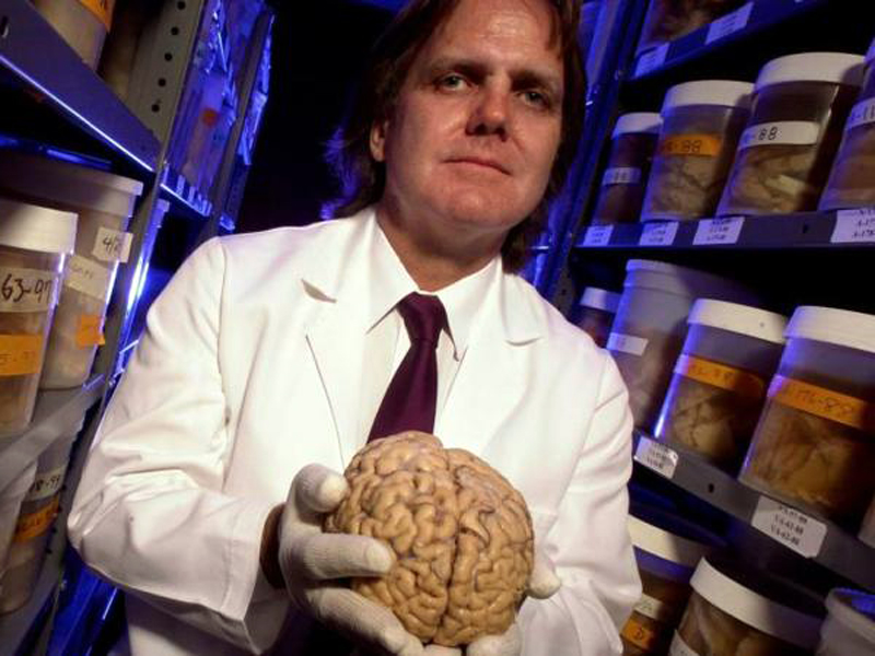 Los secretos sobre nuestro cerebro que reveló uno de los más singulares y ambiciosos estudios jamás realizado