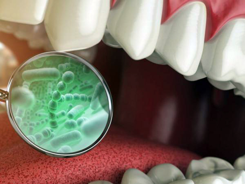 4 enfermedades vinculadas a las bacterias de tu boca